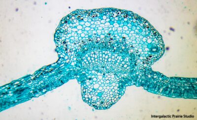 my microscope pix
